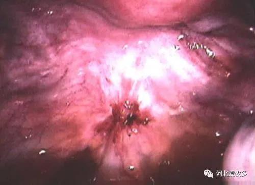 母牛子宮炎癥臨床表現